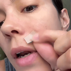Scar-care image