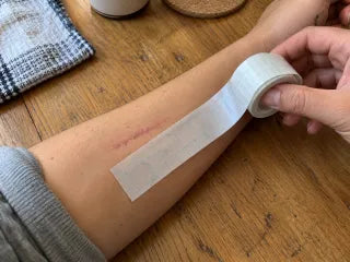Measuring a silicone scar roll with its printed grid liner