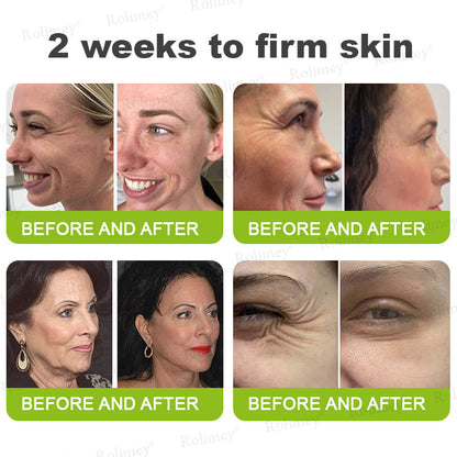 💞Made and shipped from the USA 💫Rolimey® Botox & Vita-A Retinol Shot Wrinkle-Lift Tightening cream - Last Day Promotion 70% OFF