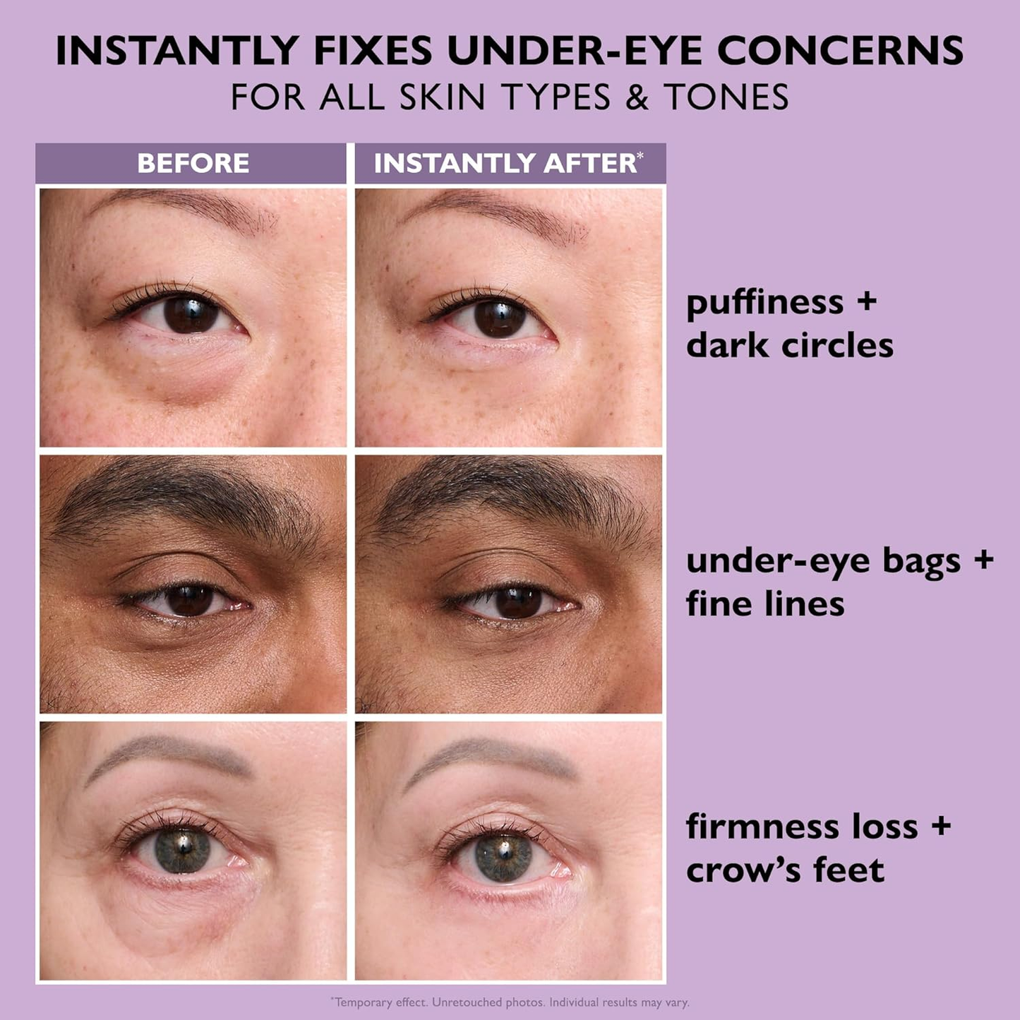 🔥 Final Hours! Save 78% on Eye Bag Eraser – Limited Stock: 58 Sets Remaining!