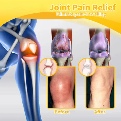 💧🥇Official Store: flysmus™ Bee-Venom Pain-Relief Bone Healing Cream👨‍⚕️Therapeutic Goods Administration (TGA) Certified