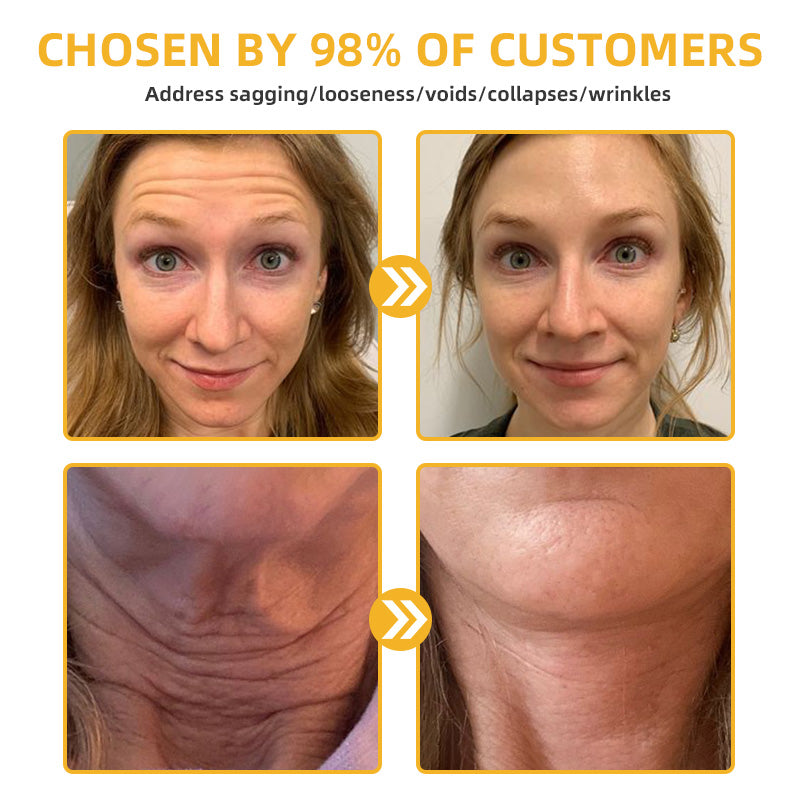 💧🍒Flysmus™ BeeLift Anti-Aging Firming Cream,Address Crepe & Sagging(🔥74% Off for a Limited Time!)