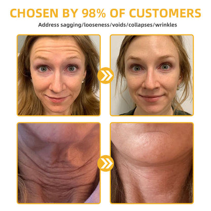 💧🍒Flysmus™ BeeLift Anti-Aging Firming Cream,Address Crepe & Sagging(🔥74% Off for a Limited Time!)