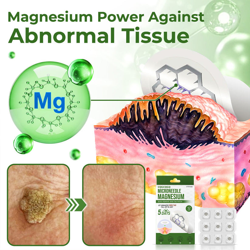 💗Final 3 Hours: 80% OFF - CQGCQGQ® Magnesium MicroNeedle Quick Remove Skin Tag Patches
