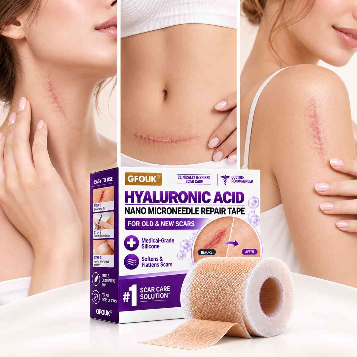 ✅GFOUK® Hyaluronic Acid Nano Microneedle Repair Tape🗽🍃