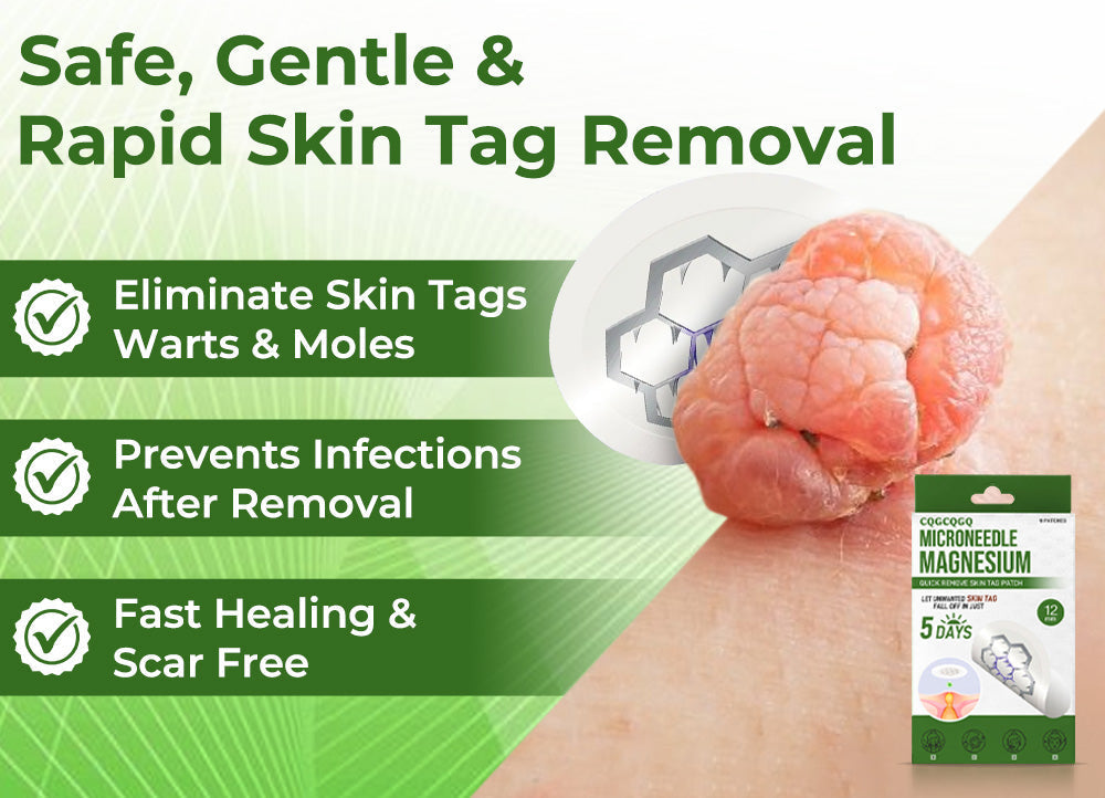 💗Final 3 Hours: 80% OFF - CQGCQGQ® Magnesium MicroNeedle Quick Remove Skin Tag Patches