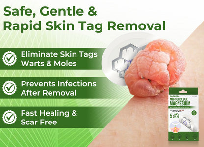 💗Final 3 Hours: 80% OFF - CQGCQGQ® Magnesium MicroNeedle Quick Remove Skin Tag Patches