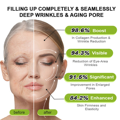 💞Made and shipped from the USA 💫Rolimey® Botox & Vita-A Retinol Shot Wrinkle-Lift Tightening cream - Last Day Promotion 70% OFF