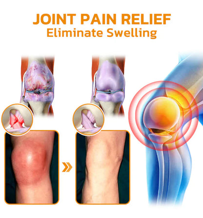 💧🥇Official Store: flysmus™ Bee-Venom Pain-Relief Bone Healing Cream👨‍⚕️Therapeutic Goods Administration (TGA) Certified