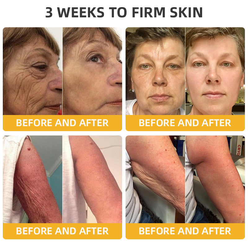 💧🍒Flysmus™ BeeLift Anti-Aging Firming Cream,Address Crepe & Sagging(🔥74% Off for a Limited Time!)