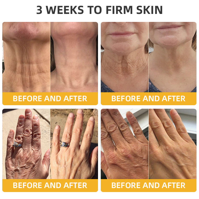 💧🍒Flysmus™ BeeLift Anti-Aging Firming Cream,Address Crepe & Sagging(🔥74% Off for a Limited Time!)