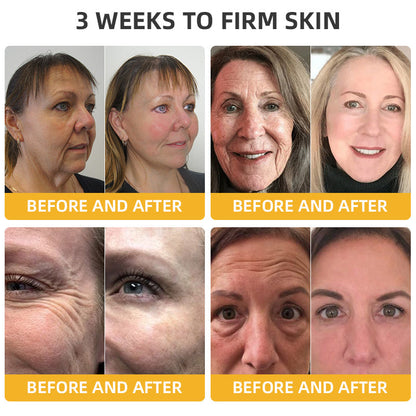 💧🍒Flysmus™ BeeLift Anti-Aging Firming Cream,Address Crepe & Sagging(🔥74% Off for a Limited Time!)