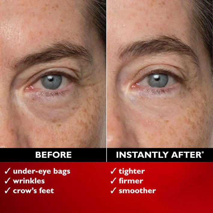🌟🔥  Last 3 Hours 50% OFF  ✨ BUY 1 GET 1 FREE🔥Eye Bag Eraser — Instantly Refreshes, Firms & Smooths for a Youthful Look That Lasts 8 Hours