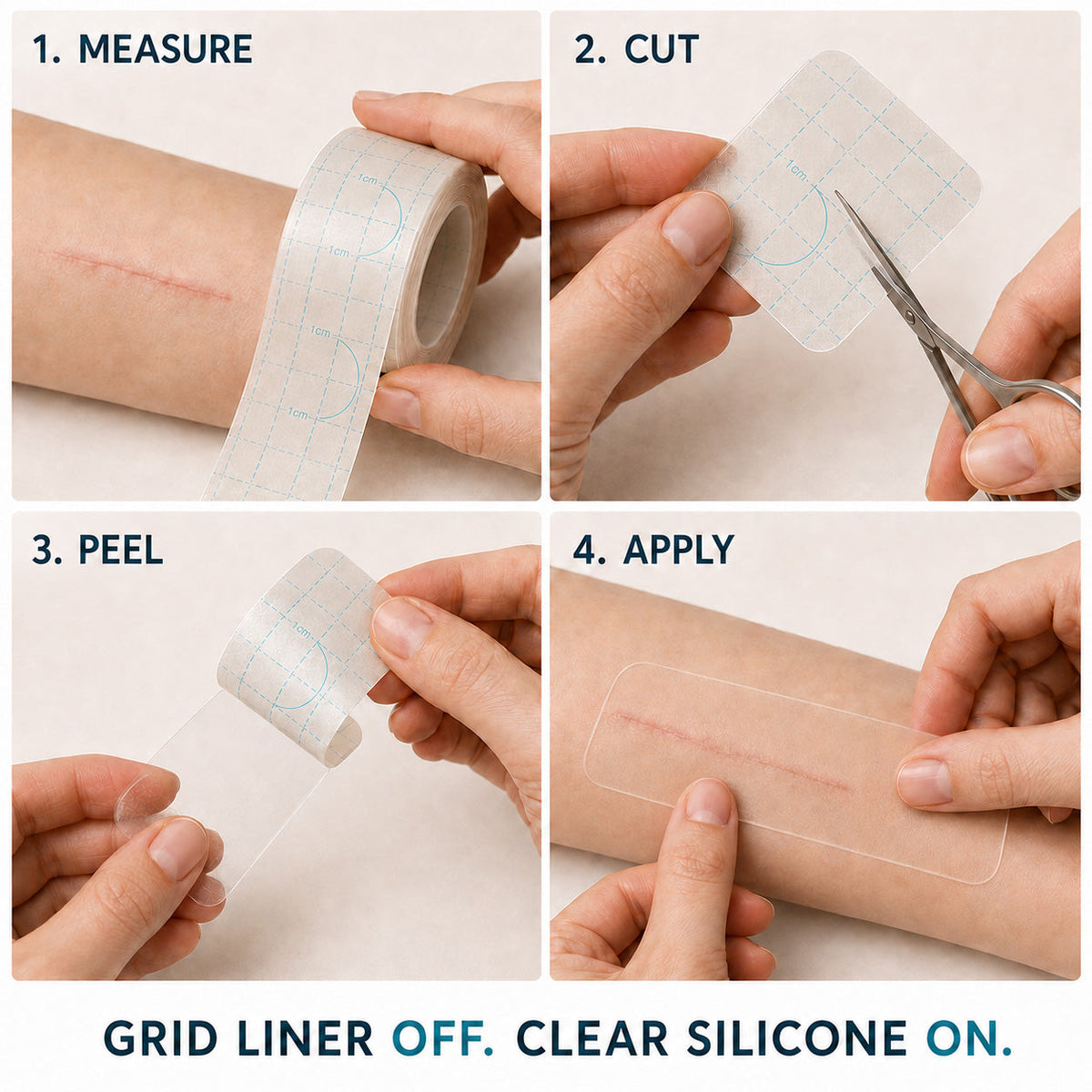 👩‍⚕️Trilumia® Silicone Scar Therapy Roll — Custom-Fit Care for Long, Raised Surgical Scars