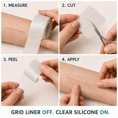 👩‍⚕️Trilumia® Silicone Scar Therapy Roll — Custom-Fit Care for Long, Raised Surgical Scars