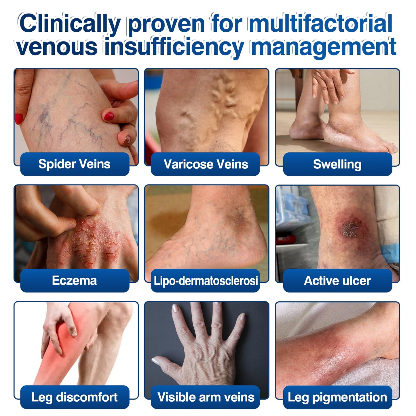 🇺🇸👨‍⚕️🦵🛡️GFOUK® VeinRenew Microneedle Balm