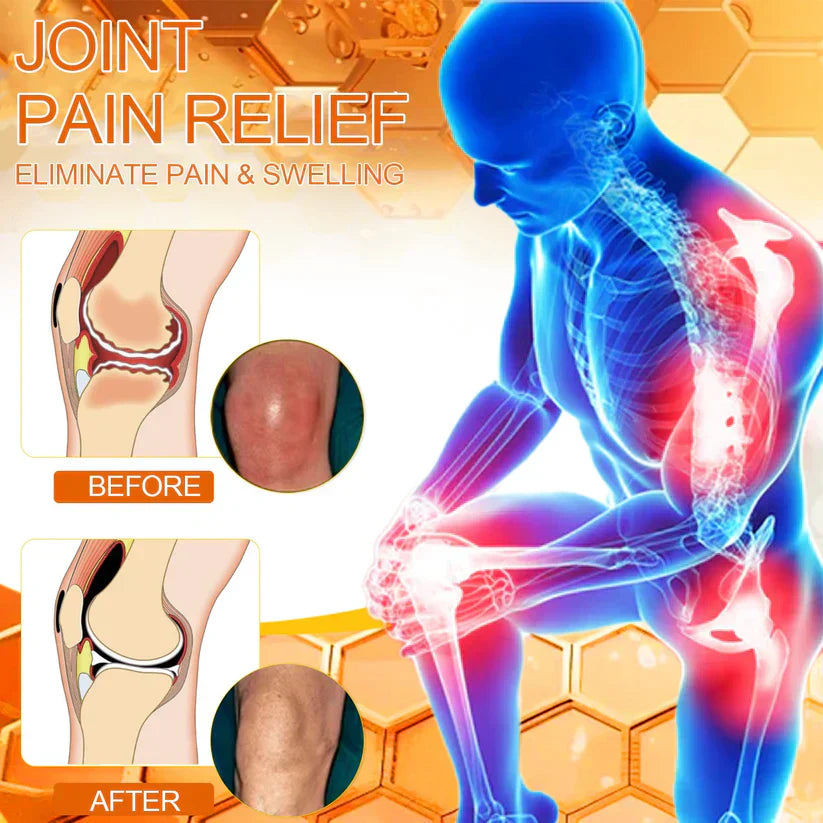 💧🥇Official Store: flysmus™ Bee-Venom Pain-Relief Bone Healing Cream👨‍⚕️Therapeutic Goods Administration (TGA) Certified