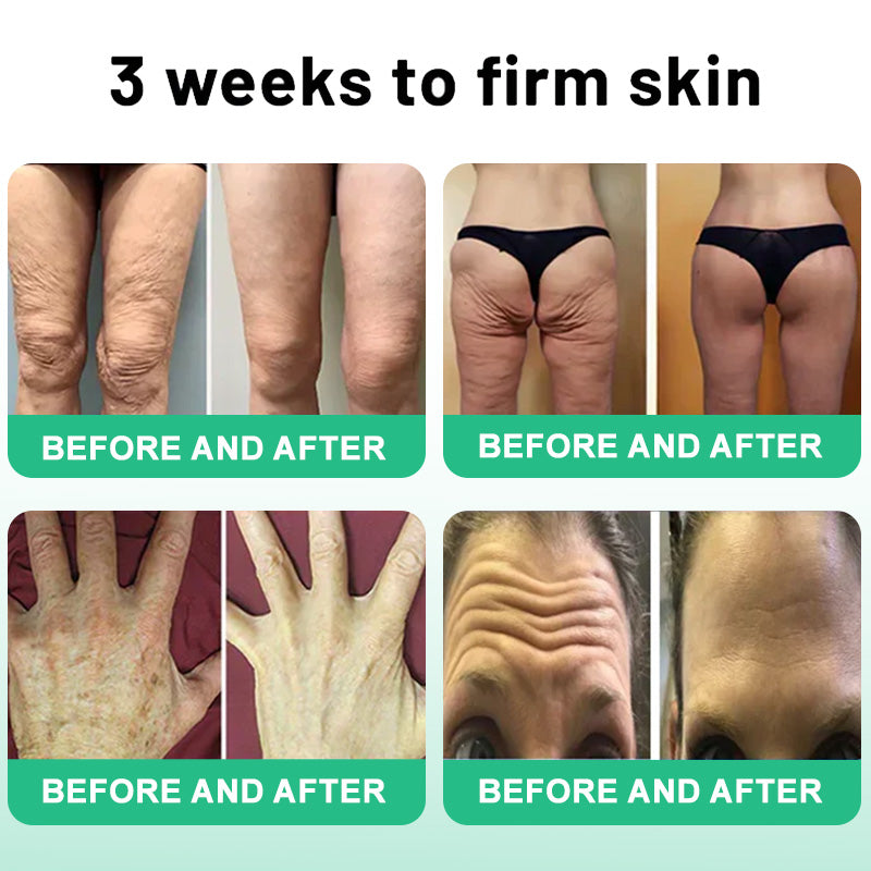 💧🍒Flysmus™ Wrinkle Removel Cream,Address Crepe & Sagging(🔥74% Off for a Limited Time!)