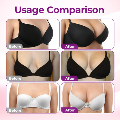 💥Turonu® 👩‍⚕️ Targeted Breast Enhancement Advanced Nano Microneedle Patch💃