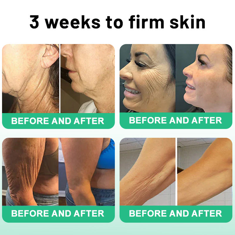 💧🍒Flysmus™ Wrinkle Removel Cream,Address Crepe & Sagging(🔥74% Off for a Limited Time!)