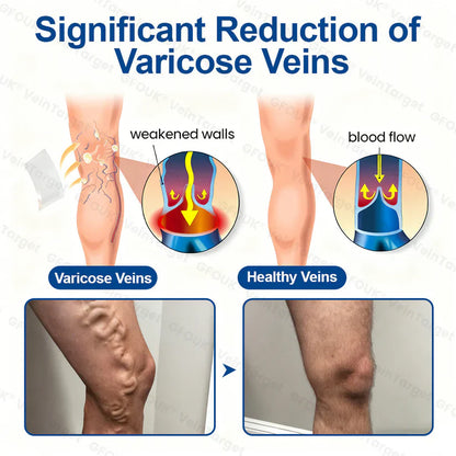 💧✅GFOUK® VeinTarget Microneedle Patch⚡Instant Relief, Long-Term Results
