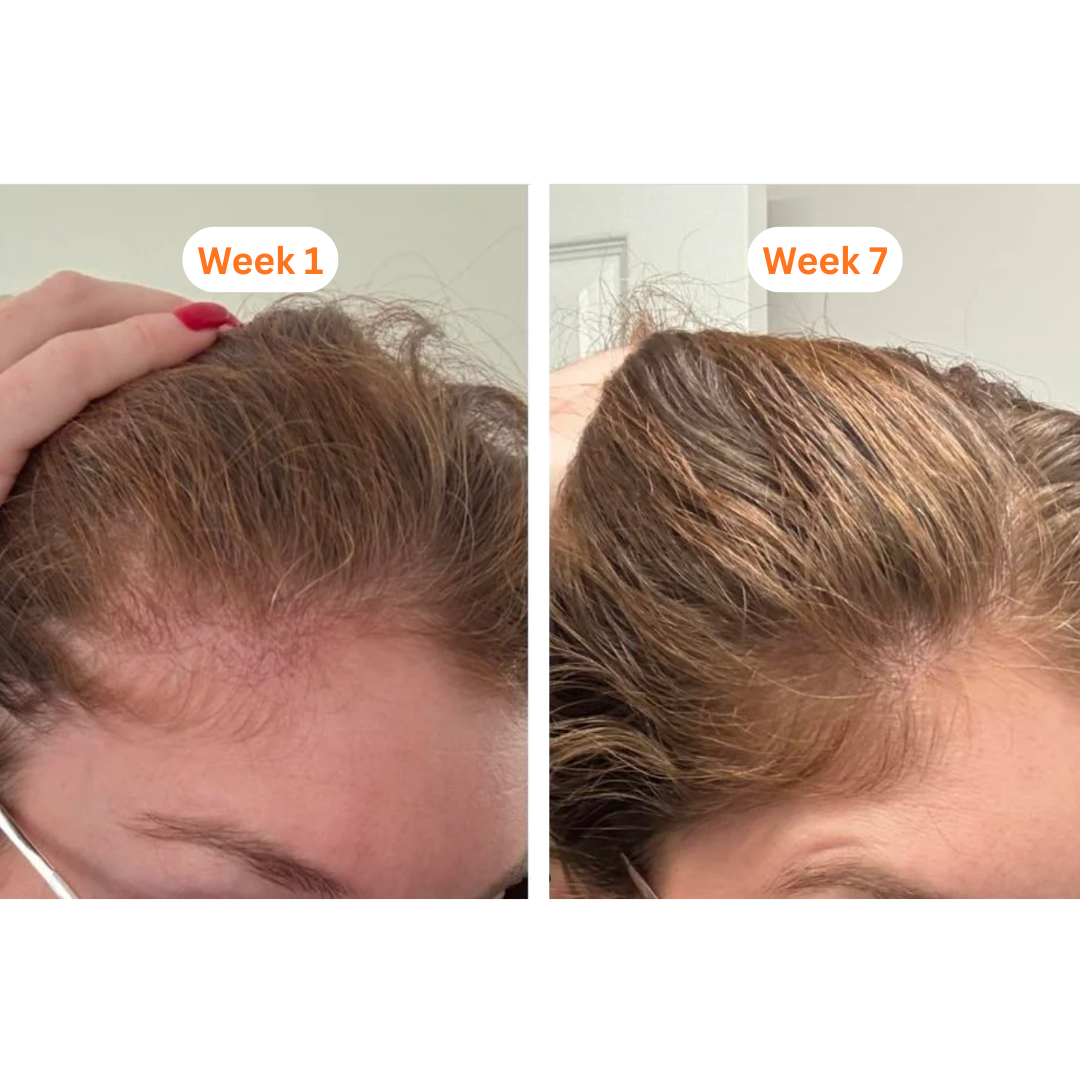 🎍Lilyove™ GrowTurn Hair Brush Serum