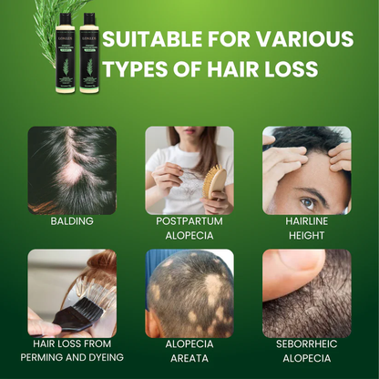 🪐LONLDS® Rosemary Keratin Shampoo for Hair Growth & Thinning Hair - Strengthens & Nourishes