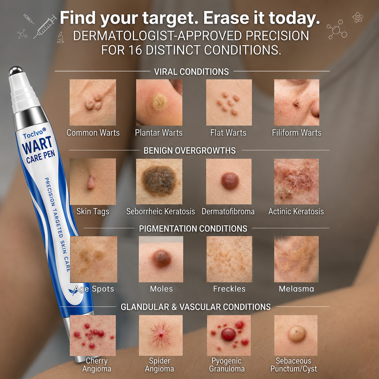 🫆 Toclvo® Fast-Acting Wart Remover Care Pen | Targets Warts, Skin Tags & Rough Bumps