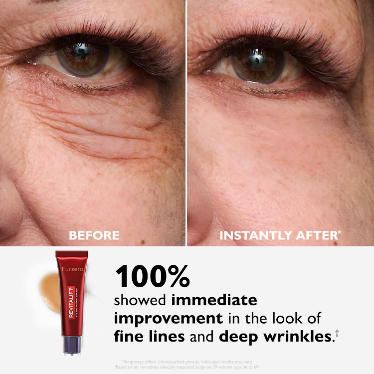 🔥 Final Hours! Save 78% on Eye Bag Eraser – Limited Stock: 58 Sets Remaining!