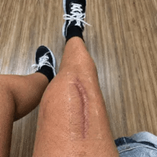 Creative scene of silicone coverage on a bent elbow
