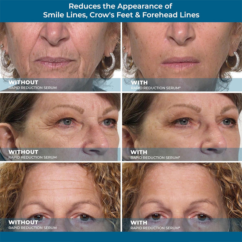 💧🪴Furzero™ All-in-One Lifting & Firming Serum Smooths wrinkles in 10 minutes, tightens skin, and reduces puffiness and dark circles