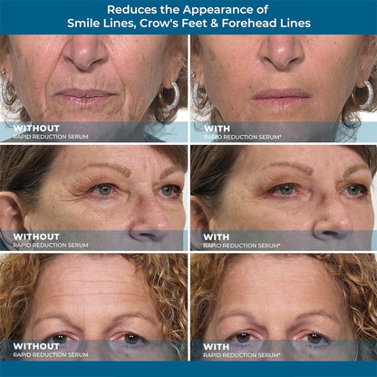 💧🪴Furzero™ All-in-One Lifting & Firming Serum Smooths wrinkles in 10 minutes, tightens skin, and reduces puffiness and dark circles