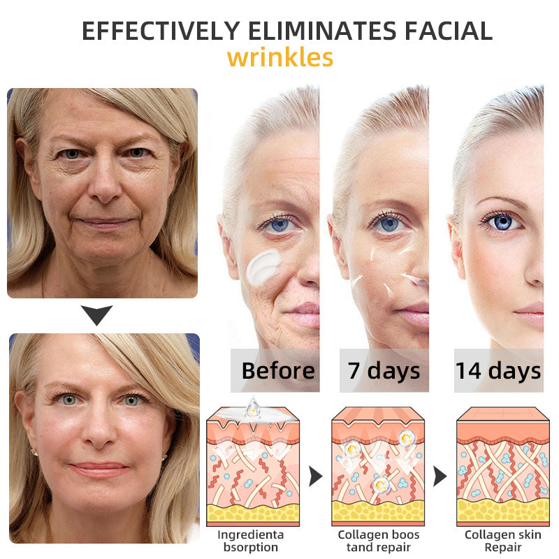 💧🍒Flysmus™ BeeLift Anti-Aging Firming Cream,Address Crepe & Sagging(🔥74% Off for a Limited Time!)