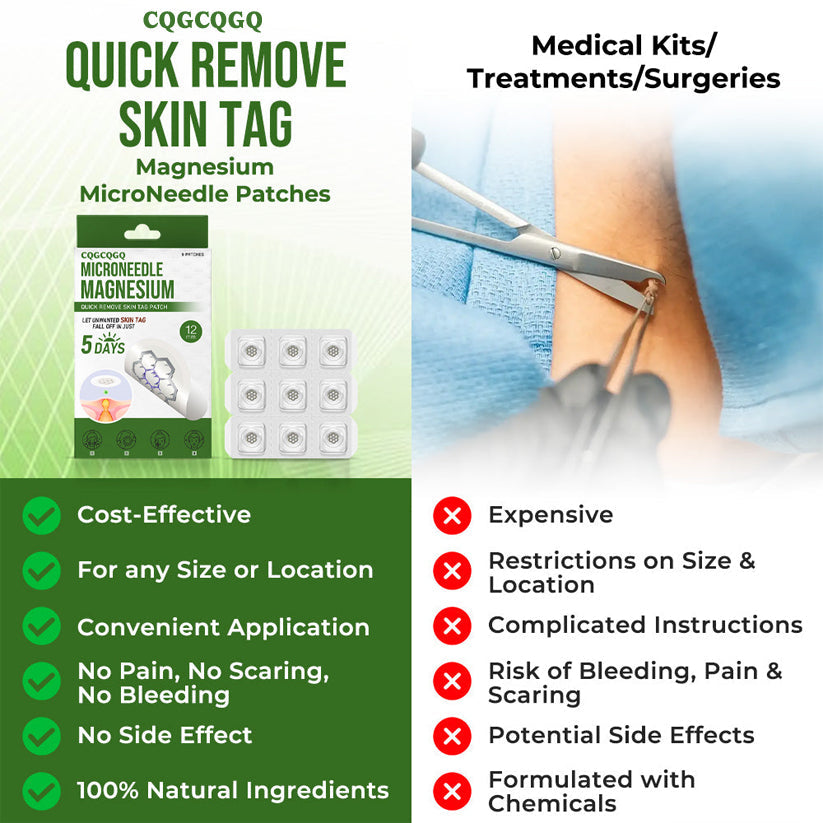 💗Final 3 Hours: 80% OFF - CQGCQGQ® Magnesium MicroNeedle Quick Remove Skin Tag Patches