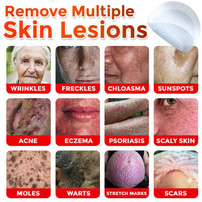 🔥🎇GFOUK® MicroNeedle Botanic Skin Tag Removal Patch 🇺🇸 Made in the USA