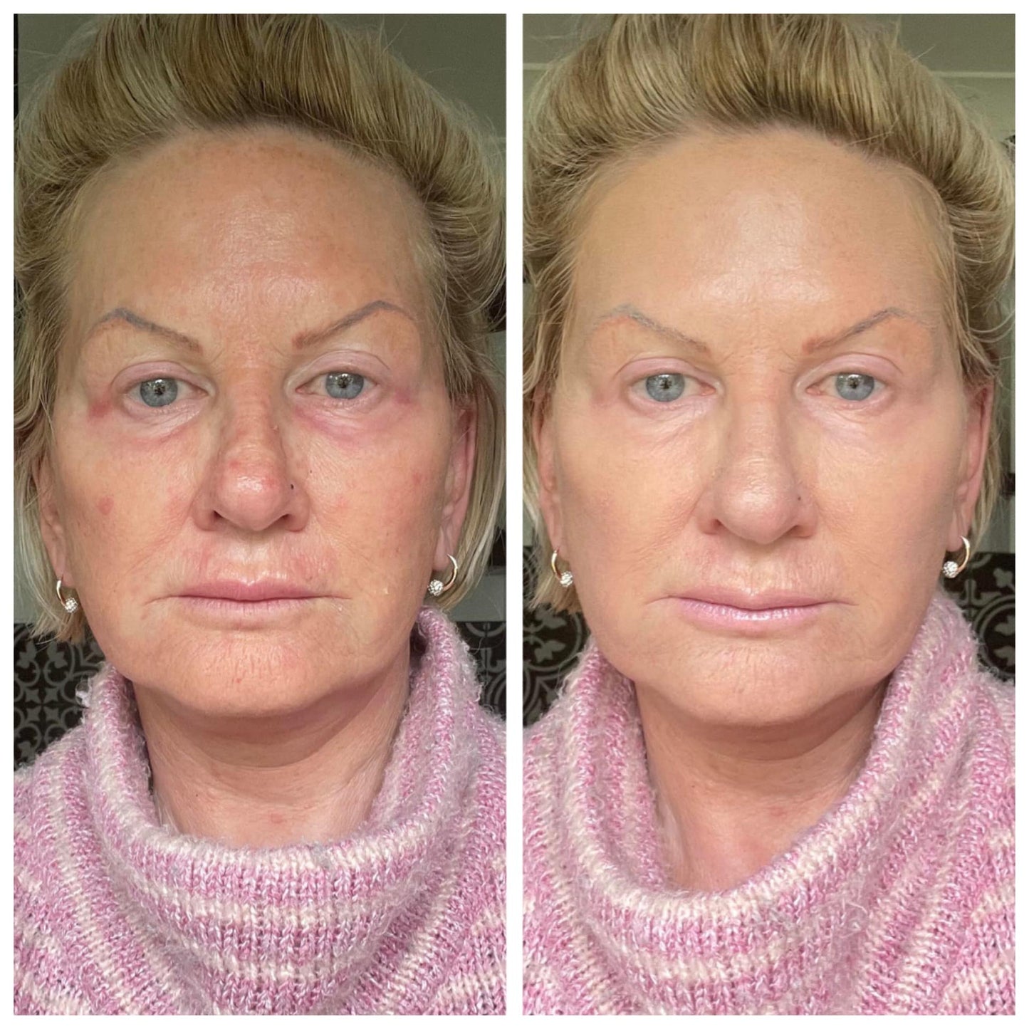 🧨Last 3 hours 60% off🔥Skin Tone Adjusting CC Cream SPF