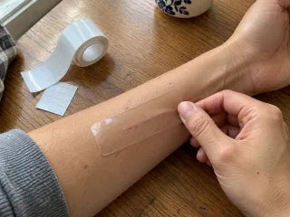 Applying the transparent silicone layer to fully healed skin