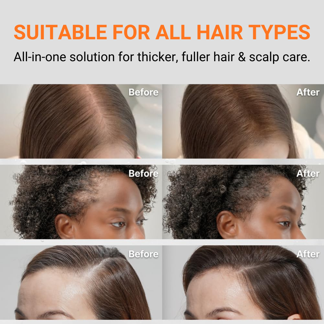 🎍Lilyove™ GrowTurn Hair Brush Serum