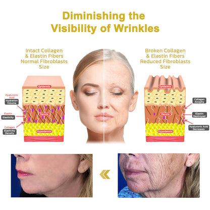 💧🍒Flysmus™ Wrinkle Removel Cream,Address Crepe & Sagging(🔥74% Off for a Limited Time!)